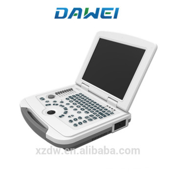 Preço portátil da máquina do varredor do ultra-som do equipamento médico do caderno DW-580